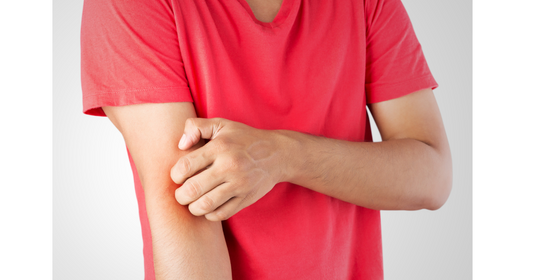 How Proper Skincare Helps Manage Eczema Symptoms