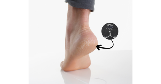 Why Urea is a Game-Changer for Dry, Cracked Skin – The Callusan Advantage